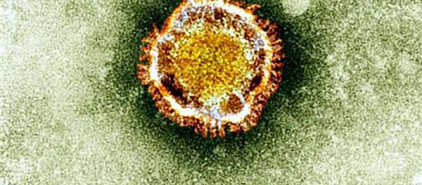 Вид на зараженную коронавирусом клетку под микроскопом  - Sputnik Грузия